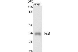 Western Blot (WB) analysis of specific cells using Pitx1 Polyclonal Antibody. (PITX1 Antikörper  (Internal Region))