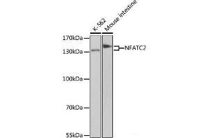 Western blot analysis of extracts of various cell lines using NFATC2 Polyclonal Antibody at dilution of 1:500. (NFAT1 Antikörper)