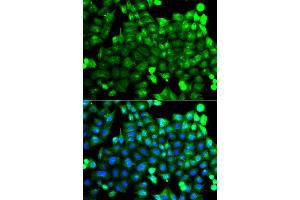 Immunofluorescence analysis of A549 cells using NCALD antibody. (NCALD Antikörper)