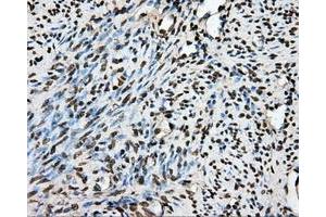 Immunohistochemical staining of paraffin-embedded Kidney tissue using anti-PTPRE mouse monoclonal antibody. (PTPRE Antikörper)
