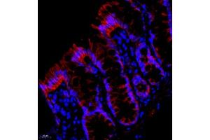 Immunofluorescent analysis of paraffin embedded rat colon using PMCA1 (ABIN7073155) at dilution of 1: 500 (ATP2B1 Antikörper)