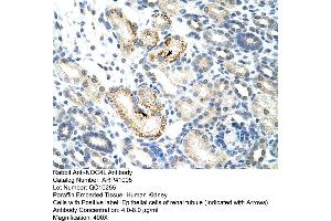 Rabbit Anti-NOC4L Antibody  Paraffin Embedded Tissue: Human Kidney Cellular Data: Epithelial cells of renal tubule Antibody Concentration: 4. (NOC4L Antikörper  (C-Term))
