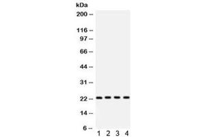 Western Blotting (WB) image for anti-BCL2-Antagonist/killer 1 (BAK1) (AA 22-211) antibody (ABIN4950296)