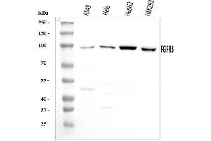Western blot analysis of FGFR3 using anti-FGFR3 antibody (ABIN7603047).