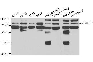 Western blot analysis of extracts of various cell lines, using KBTBD7 antibody (ABIN5975133) at 1/1000 dilution. (KBTBD7 Antikörper)
