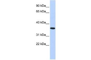 Western Blotting (WB) image for anti-CPX Chromosome Region, Candidate 1 (CPXCR1) antibody (ABIN2458436)