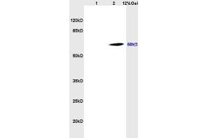 Lane 1: rat brain lysates Lane 2: human colon carcinoma lysates probed with Anti CD98 Polyclonal Antibody, Unconjugated (ABIN719546) at 1:200 in 4 °C. (SLC3A2 Antikörper  (AA 231-280))