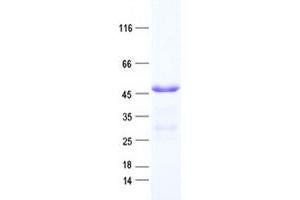 Western Blotting (WB) image for Breast Cancer Metastasis-Suppressor 1-Like (BRMS1L) protein (His tag) (ABIN2715334)