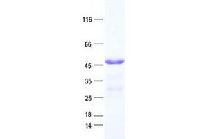 Validation with Western Blot (BRMS1L Protein (His tag))