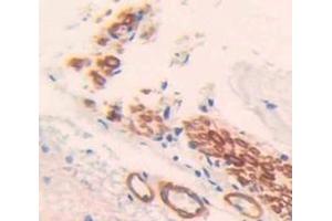 Used in DAB staining on fromalin fixed paraffin- embedded Kidney tissue (TMEFF1 Antikörper  (AA 58-312))