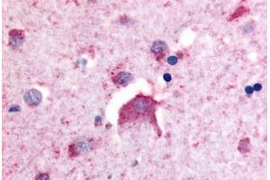 Anti-DPP6 antibody  ABIN1048510 IHC staining of human brain, neurons.