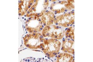 Immunohistochemical analysis of paraffin-embedded H. (BCL10 Antikörper  (AA 1-143))