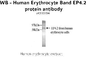 Image no. 1 for anti-erythrocyte Membrane Protein Band 4.2 (EPB42) antibody (ABIN346968) (EPB42 Antikörper)
