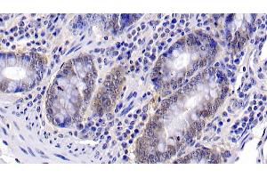 Immunohistochemistry (IHC) image for anti-Caspase 6, Apoptosis-Related Cysteine Peptidase (CASP6) (AA 81-179) antibody (ABIN7437551)