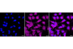 Immunocytochemical staining of HeLa cells with Deoxythymidylate kinase antibody (ABIN7798311), 1:1,000). (Rekombinanter DTYMK Antikörper)