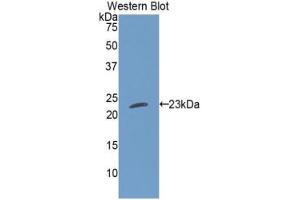 Western blot analysis of the recombinant protein. (Cardiotrophin 1 Antikörper  (AA 1-201))