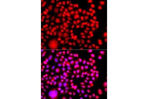Immunofluorescence analysis of A549 cells using TESK2 antibody (ABIN6292305). (TESK2 Antikörper)