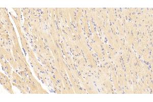 Detection of BNP in Mouse Cardiac Muscle Tissue using Polyclonal Antibody to Brain Natriuretic Peptide (BNP) (BNP Antikörper  (AA 77-121))
