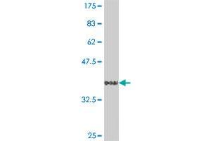 Western Blot detection against Immunogen (36. (FBXO30 Antikörper  (AA 656-745))