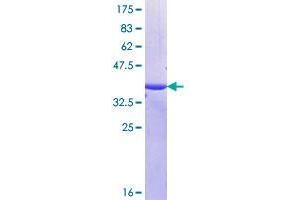 Image no. 1 for Mucin 16, Cell Surface Associated (CA125) (AA 1321-1415) protein (GST tag) (ABIN1311637)
