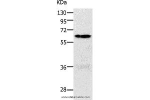 Western blot analysis of 293T and K562 cell, using PAK1 Polyclonal Antibody at dilution of 1:700 (PAK1 Antikörper)