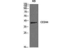 Western Blot (WB) analysis of KB cells using CD244 Polyclonal Antibody. (2B4 Antikörper  (Internal Region))