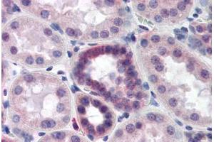 Human Kidney (formalin-fixed, paraffin-embedded) stained with CAND2 antibody ABIN218497 at 1:500 followed by biotinylated goat anti-rabbit IgG secondary antibody ABIN481713, alkaline phosphatase-streptavidin and chromogen. (CAND2 Antikörper  (C-Term))