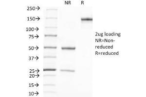 SDS-PAGE Analysis Purified PSA Mouse Monoclonal Antibody (A67-B/E3). (Prostate Specific Antigen Antikörper)