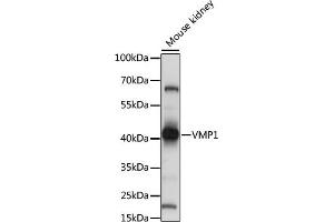 Western blot analysis of extracts of mouse kidney, using VMP1 antibody (ABIN7271283) at 1:1000 dilution. (VMP1 Antikörper  (C-Term))