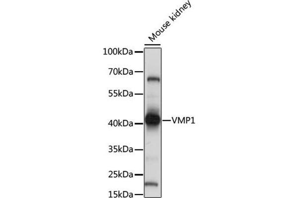 VMP1 anticorps  (C-Term)