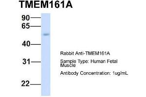 Host:  Rabbit  Target Name:  TMEM161A  Sample Type:  Human Fetal Muscle  Antibody Dilution:  1. (TMEM161A Antikörper  (Middle Region))