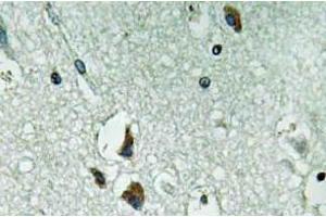 Immunohistochemistry (IHC) analyzes of PAH antibody in paraffin-embedded human brain tissue. (Phenylalanine Hydroxylase Antikörper)