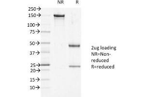 SDS-PAGE Analysis of Purified, BSA-Free DSG1 Antibody (clone 27B2).