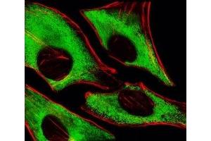 Fluorescent image of HeLa cells stained with RPS6 antibody at 1:25 dilution. (RPS6 Antikörper)