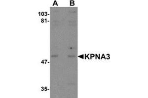 Western blot analysis of KPNA3 in EL4 cell lysate with KPNA3 antibody at (A) 1 and (B) 2 μg/ml. (KPNA3 Antikörper  (C-Term))