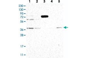 Western blot analysis of Lane 1: RT-4, Lane 2: U-251 MG, Lane 3: Human Plasma, Lane 4: Liver, Lane 5: Tonsil with STRAP polyclonal antibody  at 1:250-1:500 dilution. (STRAP Antikörper)