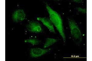 Immunofluorescence (IF) image for anti-Microtubule-Associated Protein, RP/EB Family, Member 2 (MAPRE2) (AA 1-62) antibody (ABIN564763)