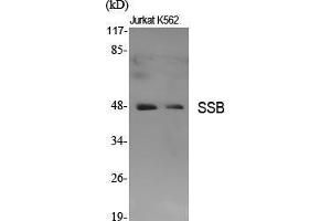 Western Blot (WB) analysis of specific cells using SSB Polyclonal Antibody. (SSB Antikörper  (Ser366))