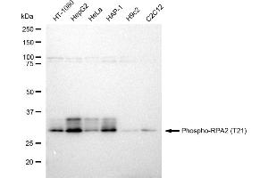 Western blotting analysis using Phospho-RPA2 (T21) antibody (ABIN7800175).
