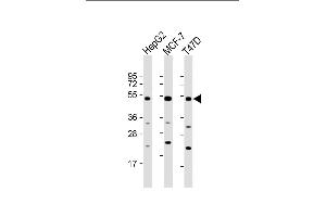 All lanes : Anti-SLC9A3R1 Antibody (Center) at 1:2000 dilution Lane 1: HepG2 whole cell lysate Lane 2: MCF-7 whole cell lysate Lane 3: T47D whole cell lysate Lysates/proteins at 20 μg per lane. (SLC9A3R1 Antikörper  (AA 168-197))