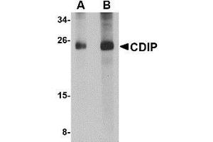 Western blot analysis of CDIP in human brain lysate with AP30219PU-N CDIP antibody at (A) 1 and (B) 2 μg/ml. (CDIP1 Antikörper  (Center))