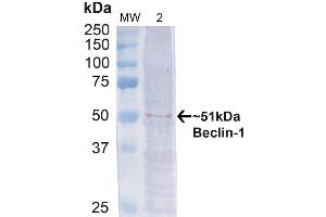 Western blot analysis of Human Cervical cancer cell line (HeLa) lysate showing detection of ~51 kDa Beclin 1 protein using Rabbit Anti-Beclin 1 Polyclonal Antibody (ABIN2868740). (Beclin 1 Antikörper  (Atto 390))