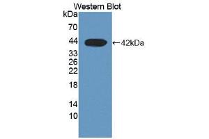 Western blot analysis of the recombinant protein. (DHODH Antikörper  (AA 35-392))