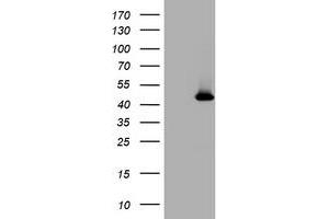 Image no. 1 for anti-Melanoma Antigen Family A, 4 (MAGEA4) antibody (ABIN1499261) (MAGEA4 Antikörper)