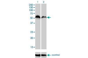 Western blot analysis of NRF1 over-expressed 293 cell line, cotransfected with NRF1 Validated Chimera RNAi (Lane 2) or non-transfected control (Lane 1).