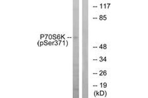 Western blot analysis of extracts from COLO205 cells treated with serum 20% 15', using p70 S6 Kinase (Phospho-Ser371) Antibody. (RPS6KB1 Antikörper  (pSer371))