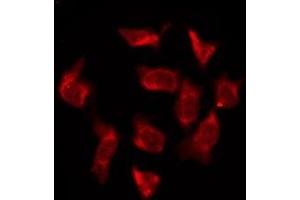 ABIN6276184 staining HeLa by IF/ICC. (OR6T1 Antikörper  (C-Term))