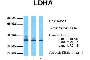 Host: Rabbit Target Name: LDHA Sample Tissue: Human Jurkat, MCF7, 721_B Antibody Dilution: 1.