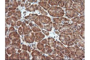 Image no. 4 for anti-Mitogen-Activated Protein Kinase Kinase 1 (MAP2K1) antibody (ABIN1499388) (MEK1 Antikörper)