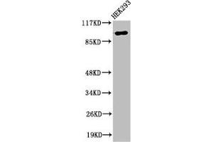 Western Blot analysis of 293 cells using RoXaN Polyclonal Antibody (ZC3H7B Antikörper  (C-Term))